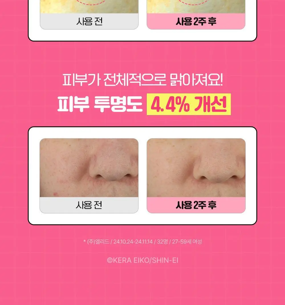 [잡티흔적] 차앤박 더마앤서 핑크토닝 딥인샷 PDRN앰플 30ml 기획 (+10ml) (아따맘마 콜라보) 상세페이지 15